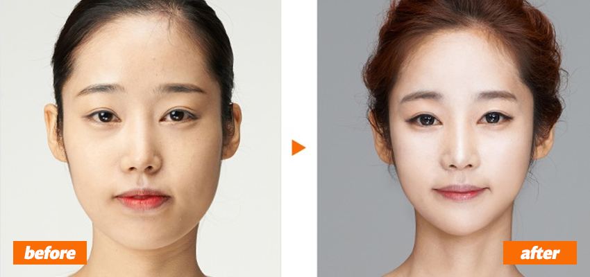 Photo: kpsurgery.tumblr.com/